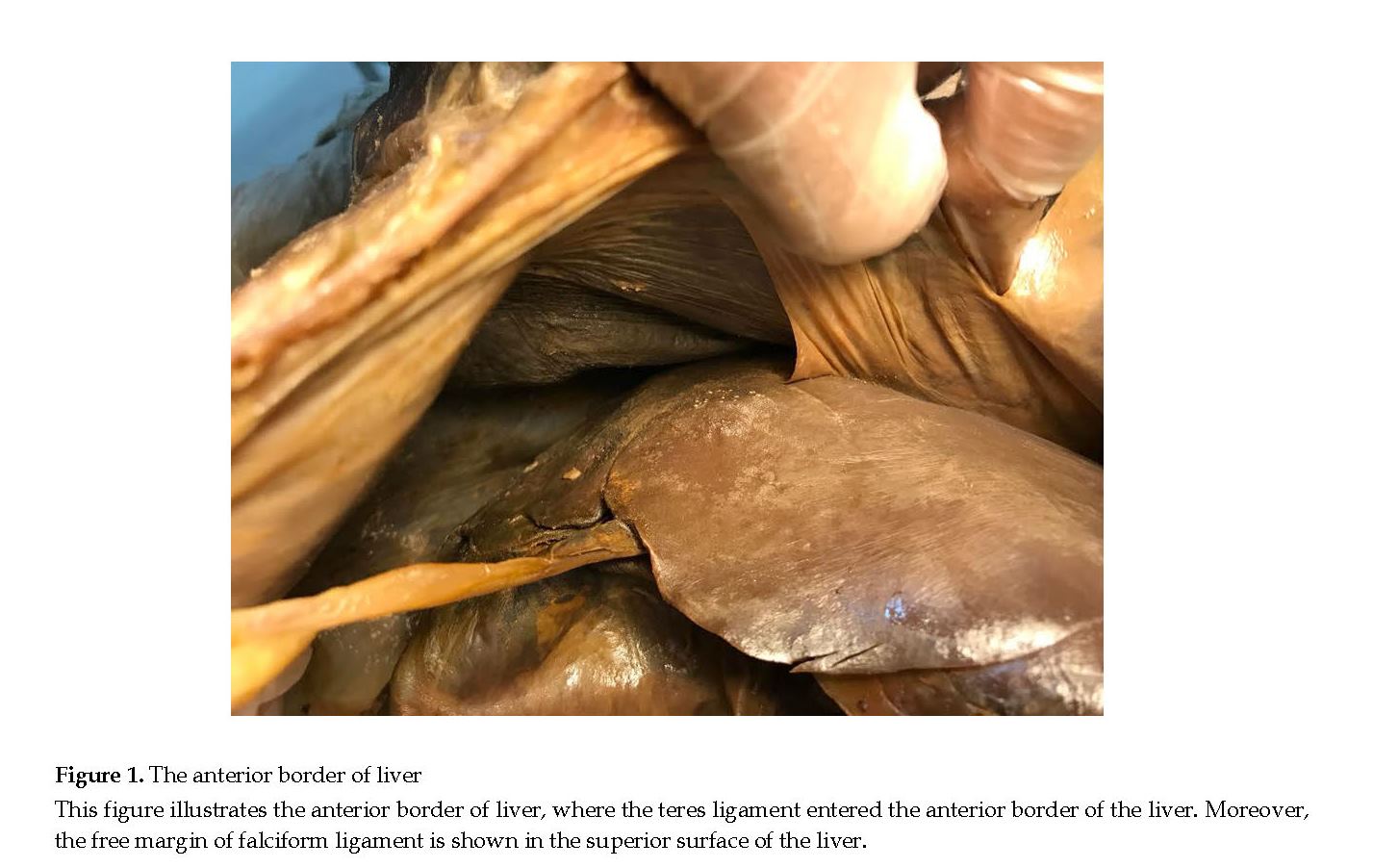 round ligament attachments